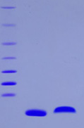 LR3 IGF-1